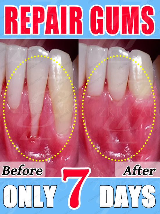 Gum recession, bleeding teeth, and tooth pain will all disappear. The most powerful technology in 2025